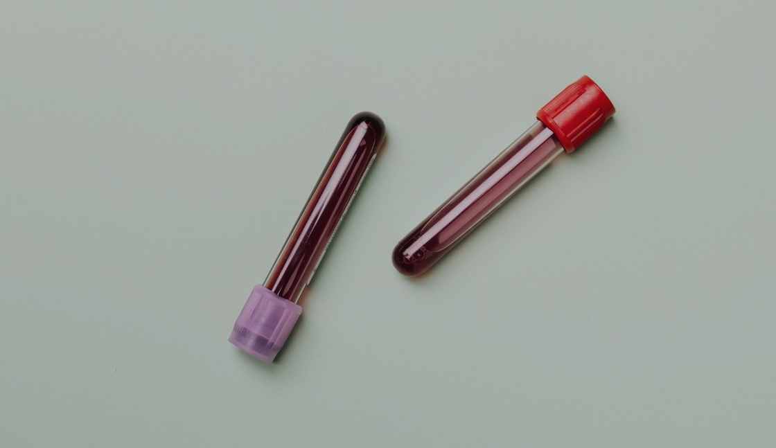 Picture of blood specimen tubes so an addiction counselor can learn how to read toxicology results.